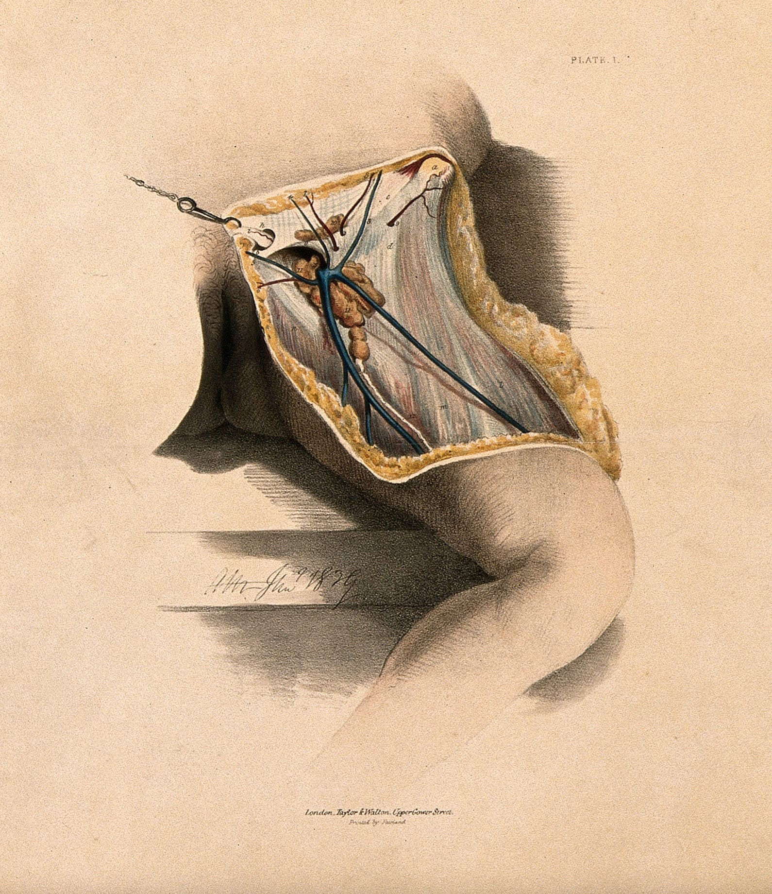 Hand-colored 1839 anatomical lithograph of a dissection of the groin, showing the fascia, blood vessels, and lymphatic vessels